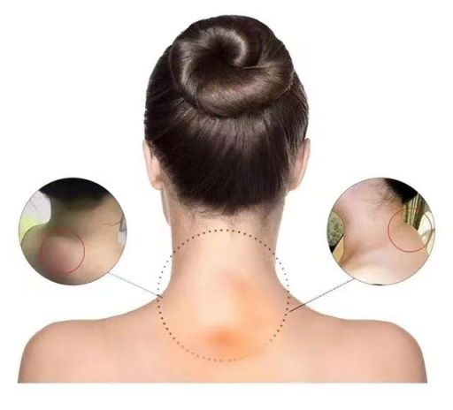 【特色治療】拒絕“富貴包”，氣質(zhì)由你定義